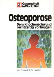 Osteoporose: Dem Knochenschwund rechtzeitig vorbeugen